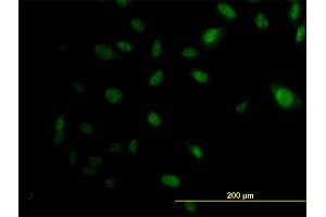 Immunofluorescence of monoclonal antibody to EP300 on HeLa cell. (p300 antibody  (AA 731-830))