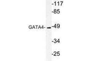 Western blot analysis of GATA4 antibody in extracts from COLO205 cells.