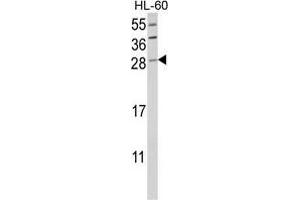 Western blot analysis of GZMB Antibody (C-term) in HL-60 cell line lysates (35 µg/lane). (GZMB antibody  (C-Term))
