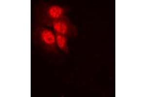 Immunofluorescent analysis of MKK1 (pT292) staining in HeLa cells.