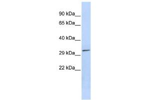 PDXP antibody used at 1 ug/ml to detect target protein. (PDXP antibody)