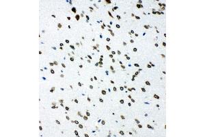 Anti-SHC antibody, IHC(F) IHC(F): Rat Brain Tissue (SHC1 antibody  (C-Term))