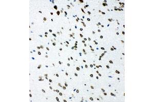 Anti-SHC antibody, IHC(F) IHC(F): Rat Brain Tissue