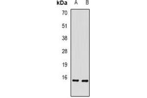 Western blot analysis of RBP2 expression in mouse intestine (A), rat liver (B) whole cell lysates. (RBP2 antibody)