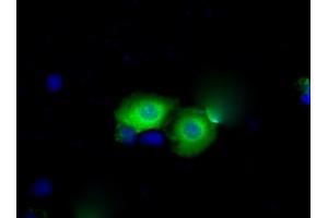 Image no. 3 for anti-3-hydroxybutyrate Dehydrogenase, Type 2 (BDH2) antibody (ABIN1496857) (BDH2 antibody)