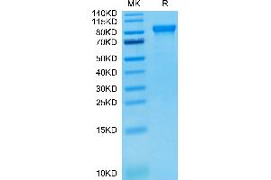 Human LILRB2 on Tris-Bis PAGE under reduced condition. (LILRB2 Protein (AA 22-458) (Fc Tag))