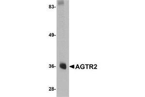 Western blot analysis of AGTR2 in mouse liver tissue lysate with AP30027PU-N AGTR2 antibody at 0. (Angiotensin II Type 2 Receptor antibody  (Center))