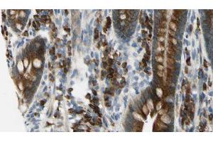 ABIN6275968 at 1/100 staining Mouse intestine tissue by IHC-P. (Adenosine A2a Receptor antibody  (Internal Region))