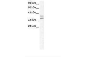 Image no. 1 for anti-Ets Homologous Factor (EHF) (AA 95-144) antibody (ABIN202193) (EHF antibody  (AA 95-144))