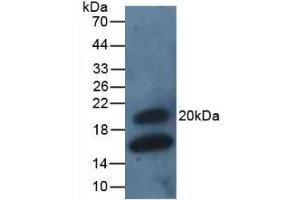 Detection of GREM1 in Rat Intestine Tissue using Polyclonal Antibody to Gremlin 1 (GREM1) (GREM1 antibody  (AA 26-184))
