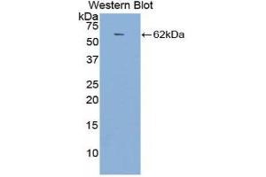 Western Blotting (WB) image for anti-Angiotensin I Converting Enzyme (Peptidyl-Dipeptidase A) 1 (ACE) (AA 814-1071) antibody (ABIN1857858)