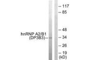Western blot analysis of extracts from HepG2 cells, using hnRNP A2/B1 Antibody.