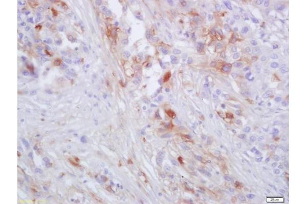 CCR2 antibody