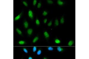 Immunofluorescence analysis of HeLa cells using CBX5 Polyclonal Antibody (CBX5 antibody)