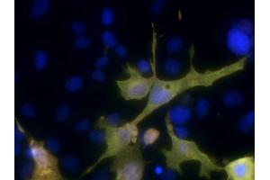 Immunofluorescence of COS cells expressing 6xHis/Myc-tagged human VDAC1.