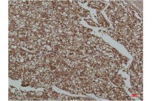 Immunohistochemistry (IHC) analysis of paraffin-embedded Human Liver Tissue using Smad3 Mouse Monoclonal Antibody diluted at 1:200. (SMAD3 antibody)