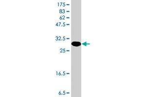 Western Blot detection against Immunogen (35.