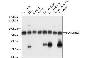Western blot analysis of extracts of various cell lines, using POMGNT2 antibody (ABIN7267482) at 1:3000 dilution. (C3orf39 antibody  (AA 160-340))