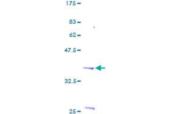 S100P Protein (AA 1-95) (GST tag)