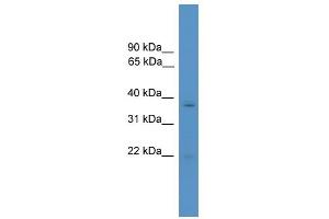 WB Suggested Anti-RHOXF1 Antibody Titration:  0. (RHOXF1 antibody  (N-Term))