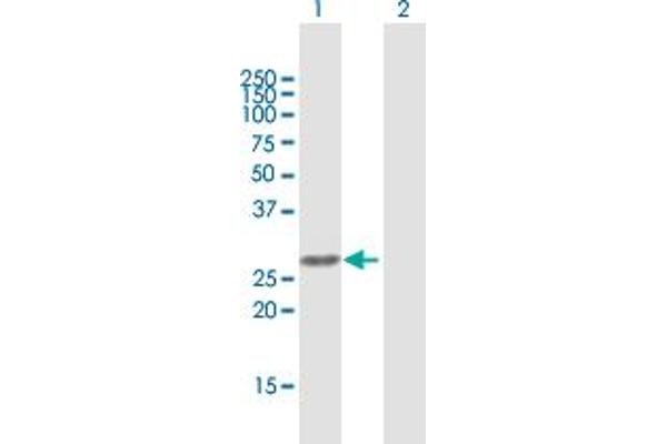 AURKAIP1 antibody  (AA 1-199)