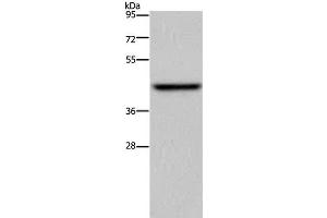Western Blot analysis of Mouse liver tissue using ENTPD5 Polyclonal Antibody at dilution of 1:500 (ENTPD5 antibody)