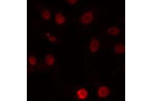 ABIN6274222 staining Hela cells by IF/ICC. (ERCC5 antibody  (N-Term))