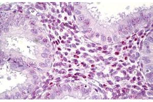 Anti-HMGB1 antibody IHC staining of human, uterus. (HMGB1 antibody  (AA 131-180))