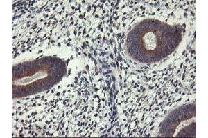Immunohistochemical staining of paraffin-embedded Human endometrium tissue using anti-ALG2 mouse monoclonal antibody.