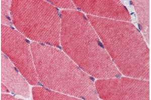 Human Skeletal Muscle: Formalin-Fixed, Paraffin-Embedded (FFPE) (TRIM5 antibody)