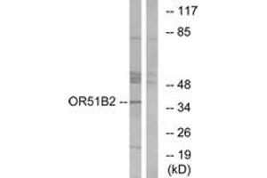 Western blot analysis of extracts from HT-29 cells, using OR51B2 Antibody. (OR51B2 antibody  (AA 196-245))