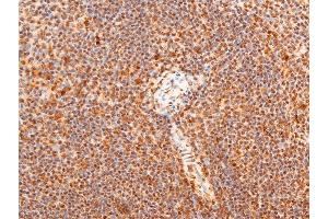 Immunohistochemistry (IHC) image for anti-Jun Proto-Oncogene (JUN) (pThr91) antibody (ABIN6256604)
