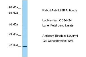 Host: Rabbit Target Name: IL28B Sample Type: Fetal Lung Antibody Dilution: 1. (IL28B antibody  (C-Term))