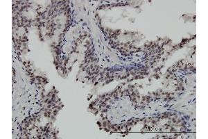 Immunoperoxidase of monoclonal antibody to STK32C on formalin-fixed paraffin-embedded human prostate. (STK32C antibody  (AA 1-369))
