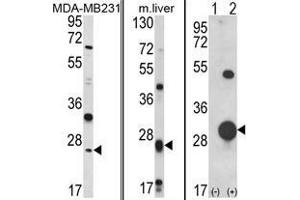 (LEFT) Western blot analysis of GSTM1 Antibody (C-term) in MDA-MB231 cell line lysates (35 µg/lane). (GSTM1 antibody  (C-Term))