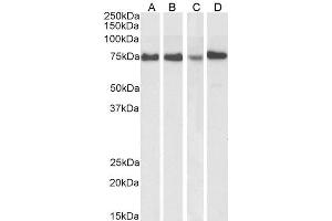 ABIN1590087 (1µg/ml) staining of HeLa (A) and MCF7 (B) cell lysate, and HeLa (C) and Jurkat (D) nuclear cell lysate(35µg protein in RIPA buffer). (ATF6 antibody  (AA 437-449))