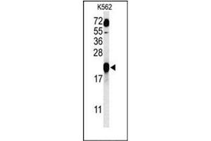 Western blot analysis of GAGE7 Antibody (C-term) in K562 cell line lysates (35ug/lane). (G Antigen 7 antibody  (C-Term))