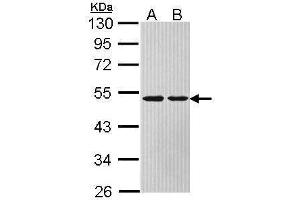WB Image Sample (30 ug of whole cell lysate) A: Hela B: Hep G2 , 10% SDS PAGE antibody diluted at 1:1000 (ASL antibody)