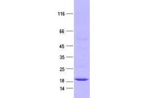 Validation with Western Blot (Ctag1a,ctag1b protein (DYKDDDDK Tag))