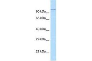 Image no. 1 for anti-ADAM Metallopeptidase Domain 29 (ADAM29) (AA 101-150) antibody (ABIN6748266) (ADAM29 antibody  (AA 101-150))