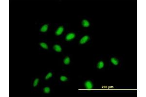 Immunofluorescence of monoclonal antibody to CDYL on HeLa cell. (CDYL antibody  (AA 153-260))