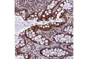 Immunohistochemical staining of human rectum with GIMAP1 polyclonal antibody  shows strong cytoplasmic positivity in glandular cells. (GTPase, IMAP Family Member 1 (GIMAP1) antibody)