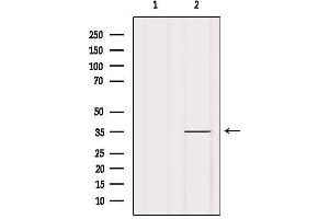 Western blot analysis of extracts from Mouse spleen, using OR1A2 Antibody. (OR1A2 antibody)