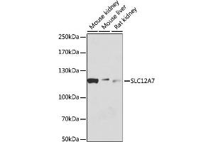 Western blot analysis of extracts of various cell lines, using SLC12 antibody (ABIN6131138, ABIN6147845, ABIN6147846 and ABIN6215907) at 1:1000 dilution. (SLC12A7 antibody  (AA 1-70))
