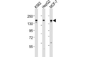 All lanes : Anti-RGEF1 Antibody (Center) at 1:1000-1:2000 dilution Lane 1: K562 whole cell lysates Lane 2: HepG2 whole cell lysates Lane 3: MCF-7 whole cell lysates Lysates/proteins at 20 μg per lane. (GRF2 antibody  (AA 536-569))