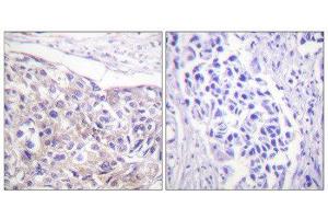 Immunohistochemistry (IHC) image for anti-Ribosomal Protein S6 Kinase, 90kDa, Polypeptide 3 (RPS6KA3) (pThr573) antibody (ABIN1847291) (RPS6KA3 antibody  (pThr573))