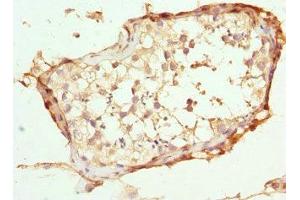 Immunohistochemistry of paraffin-embedded human testis tissue using ABIN7144903 at dilution of 1:100 (ABCC11 antibody  (AA 1-170))