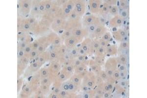 IHC-P analysis of Human Tissue, with DAB staining. (IGFBPI antibody  (AA 159-249))