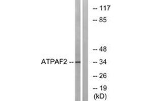 Western blot analysis of extracts from Jurkat cells, using ATPAF2 Antibody. (ATPAF2 antibody  (AA 21-70))