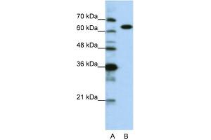 WB Suggested Anti-KARS Antibody Titration:  0. (KARS antibody  (C-Term))